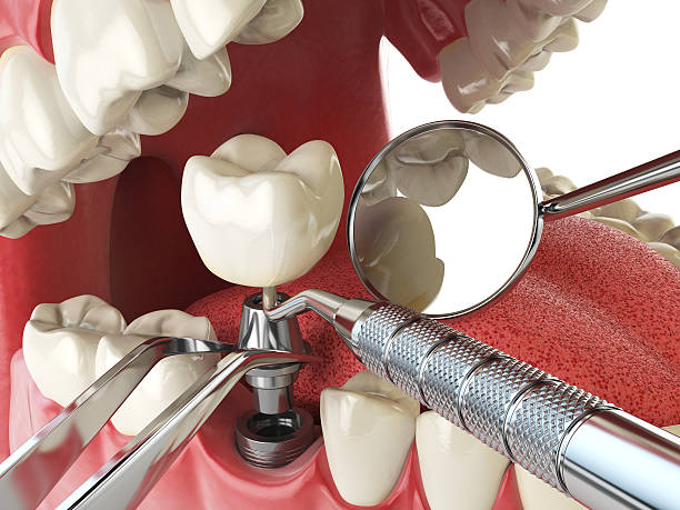 Best Emergency Treatment for Jaw Pain or Injury in Los Alamos, NM